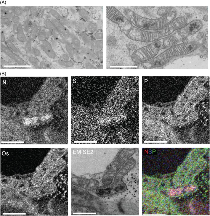EJHF-1154-FIG-0004-c