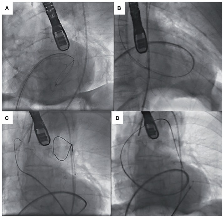 Figure 4