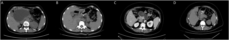 Fig. 1