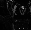 FIG. 1.