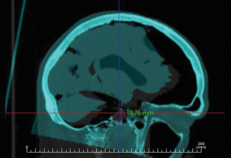 Fig. 2
