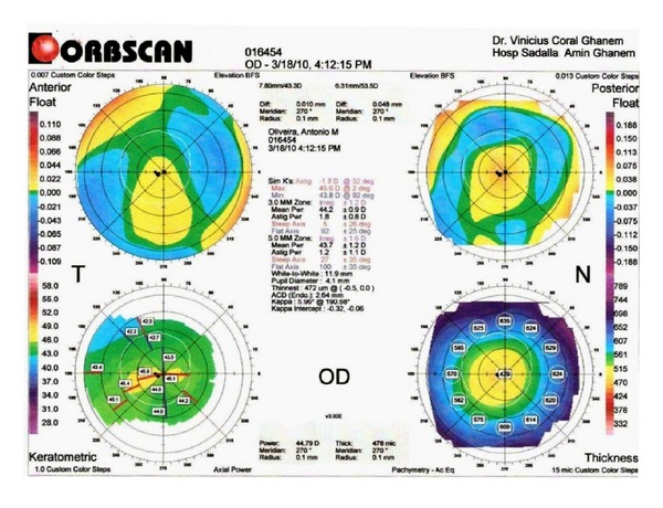 Figure 2