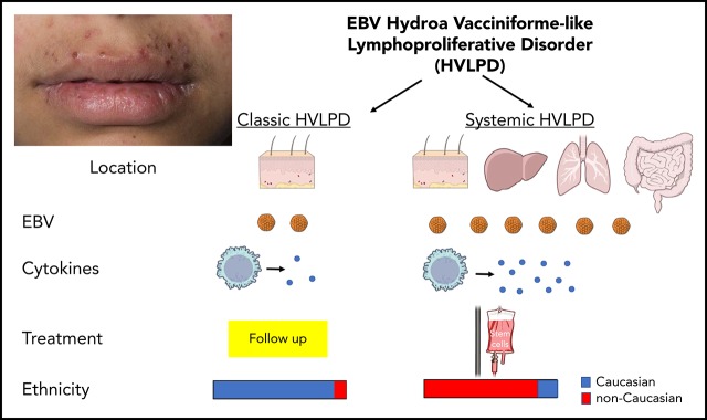 graphic file with name blood893750absf1.jpg