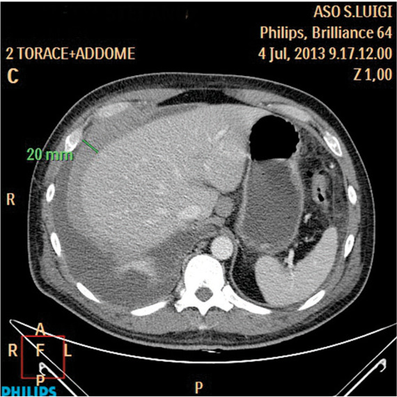 Fig. 4