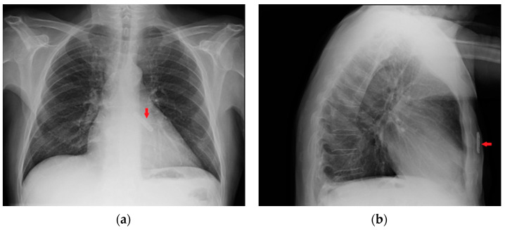 Figure 13