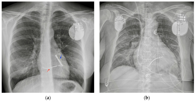 Figure 14