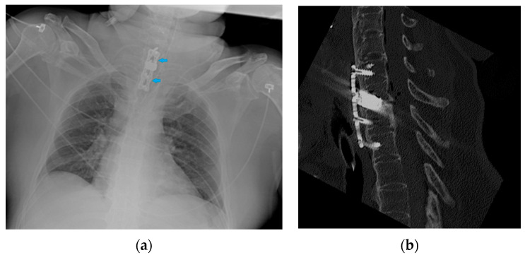 Figure 35