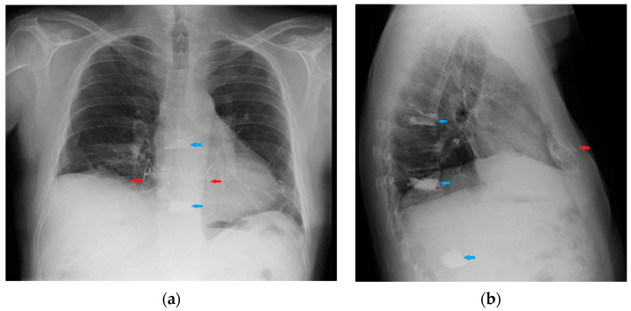 Figure 36