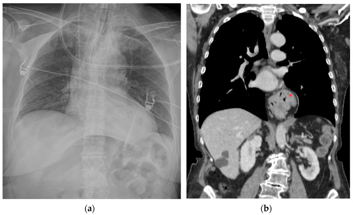 Figure 26