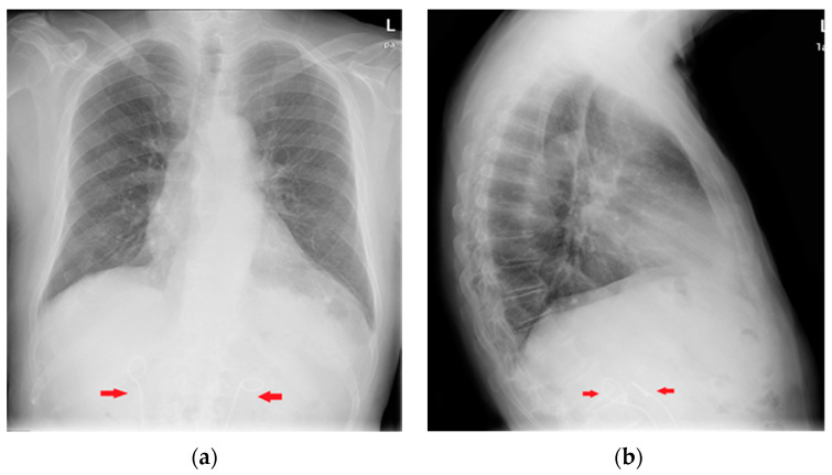 Figure 38