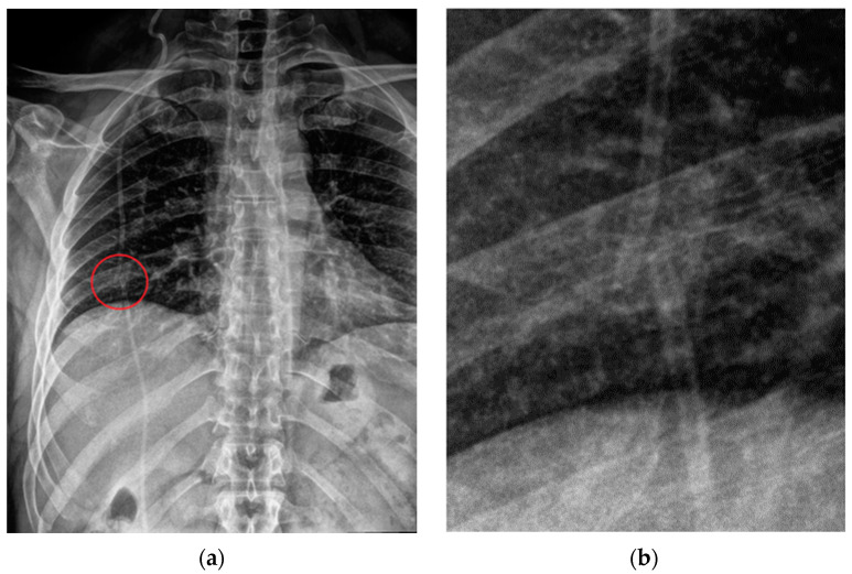 Figure 33