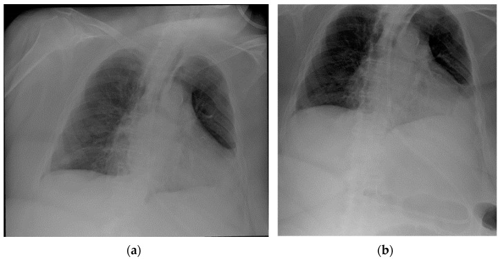 Figure 23