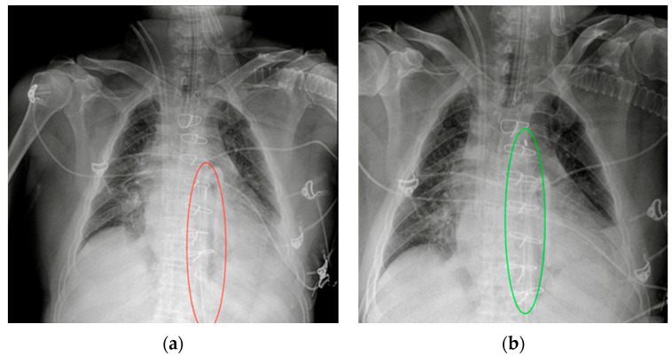 Figure 17