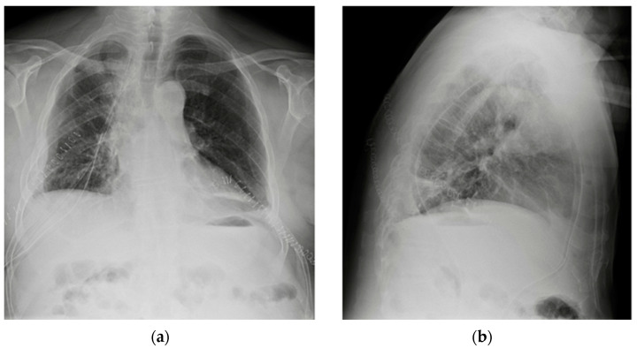 Figure 29