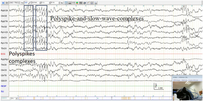 Figure 10