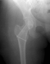 Fig. 1