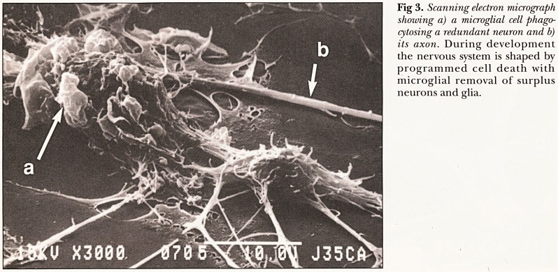 Fig 3.