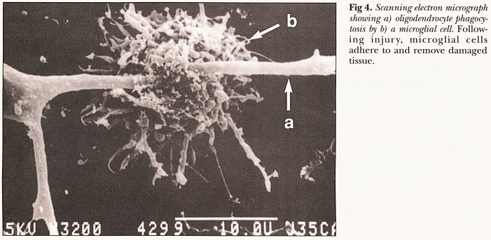 Fig 4.