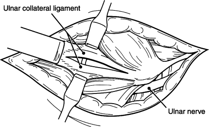 Fig. 7