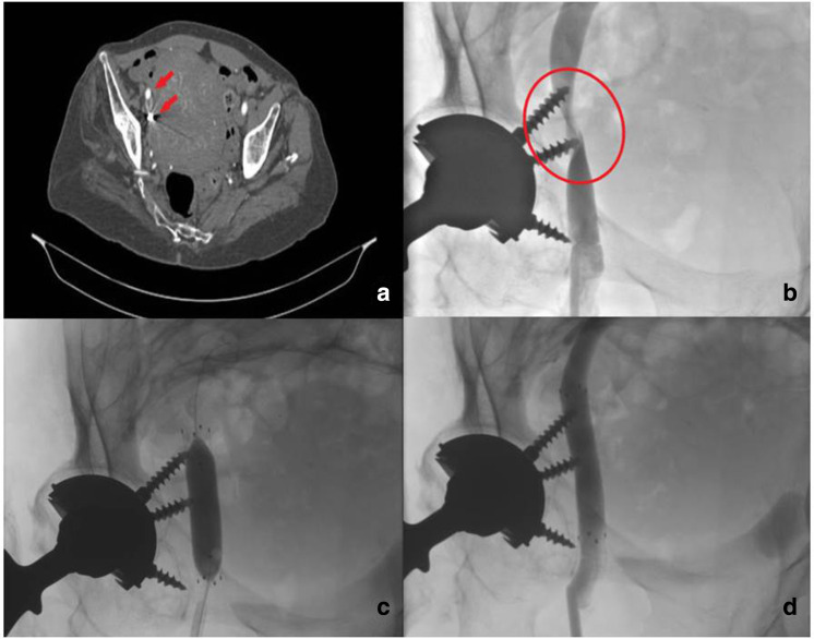 Fig. 4