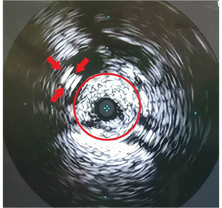 Fig. 3