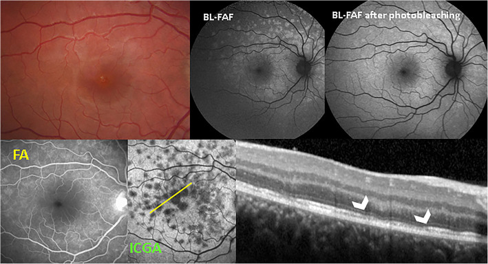 Fig. 10