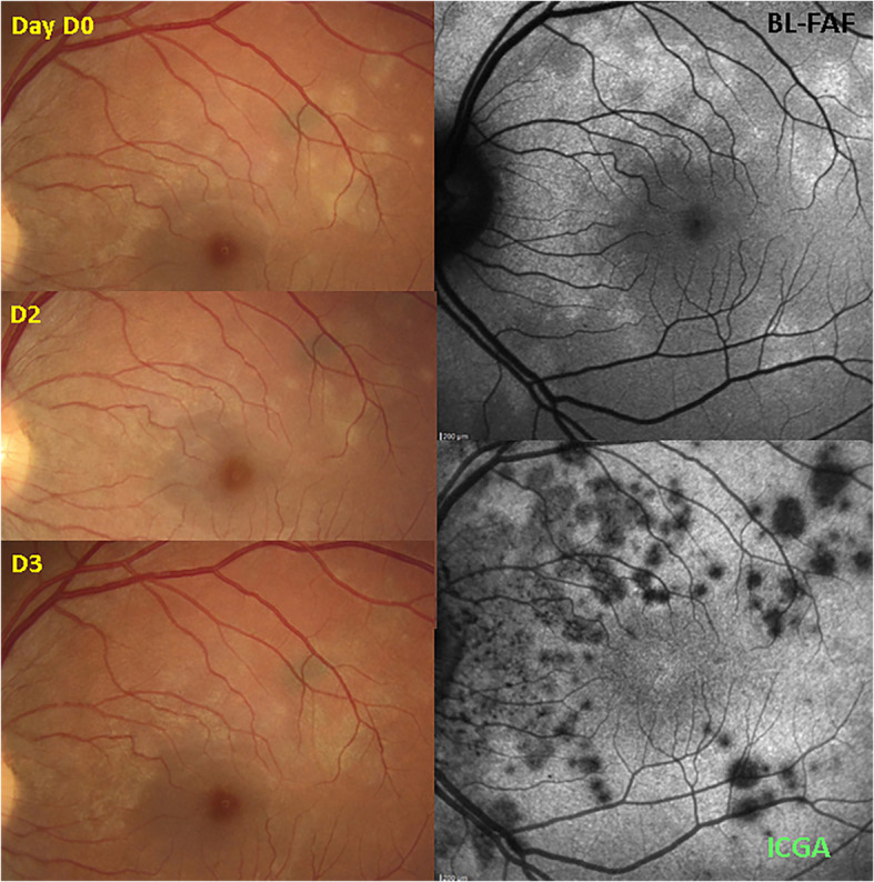 Fig. 11