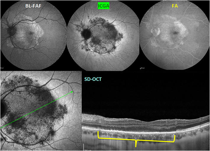 Fig. 13