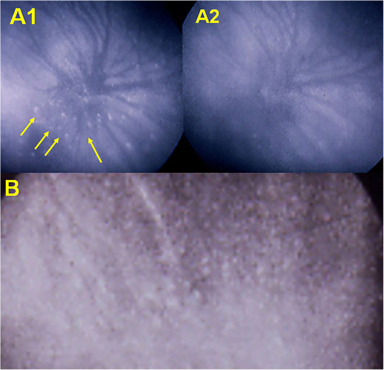 Fig. 8