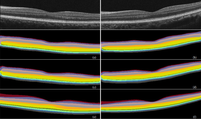 Figure 10.