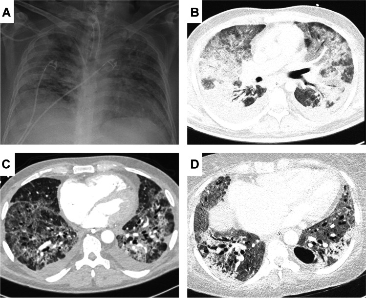 Fig. 2