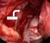 Fig.3