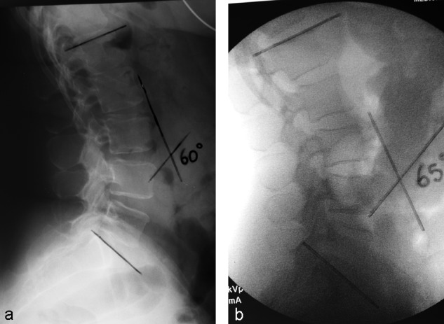 Fig 2a–b