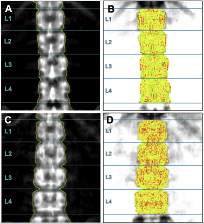 Figure 1