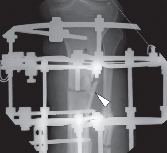 Fig. 1c