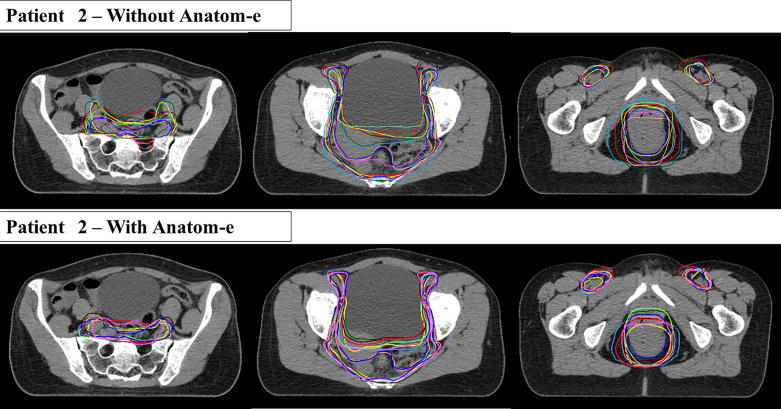 Fig. 4