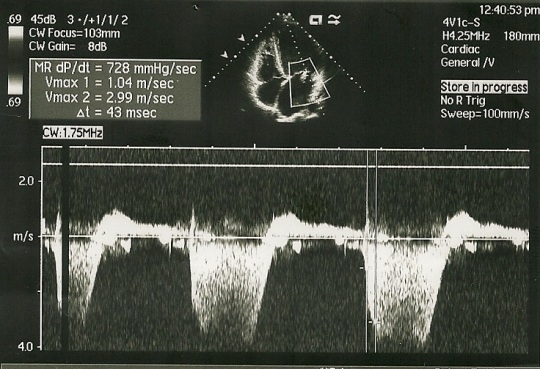 Fig. 3C