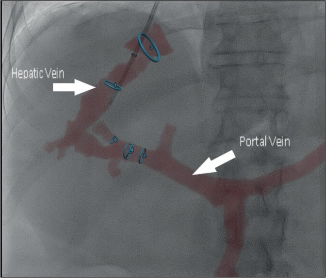 Figure 4.