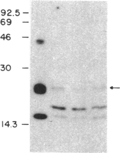 graphic file with name pnas00364-0173-d.jpg