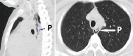 Fig. 1