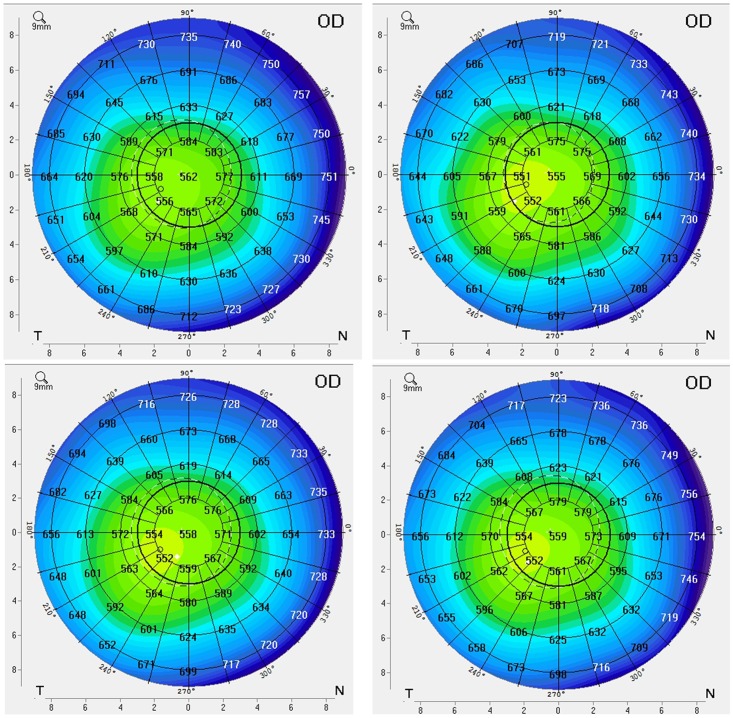 Fig 4