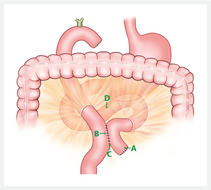 Fig. 1