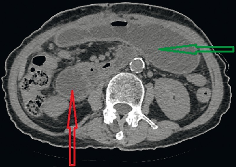 Fig. 3