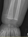 Figure 12.