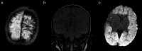 Figure 13.