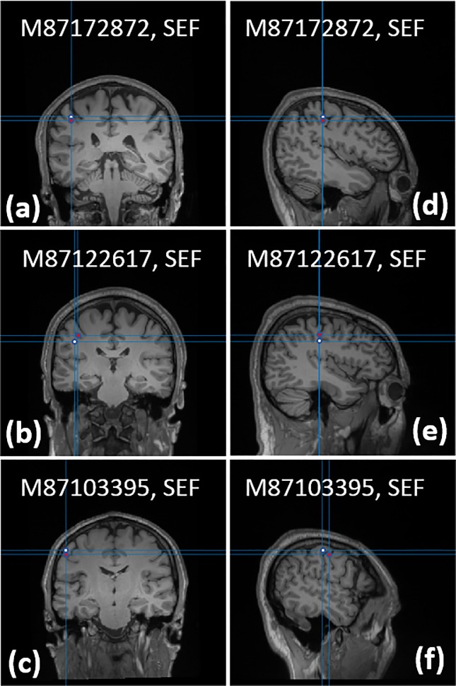 Fig 13