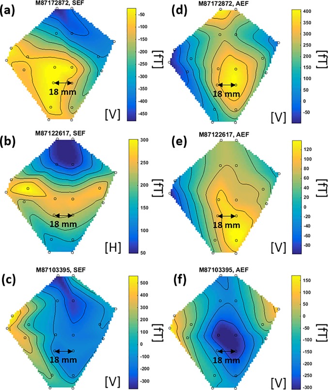 Fig 12