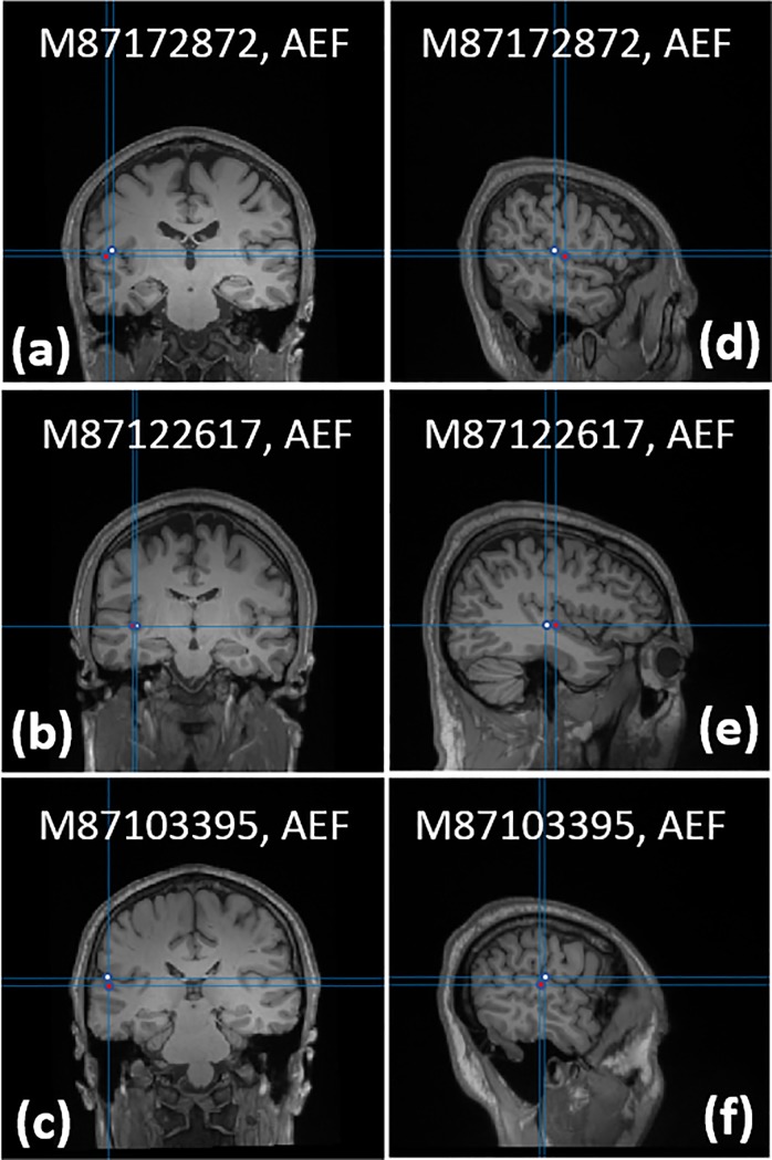 Fig 14