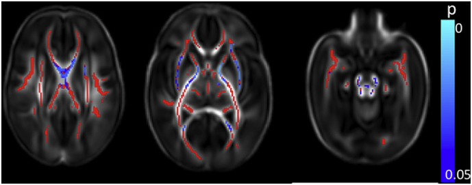 Fig. s4