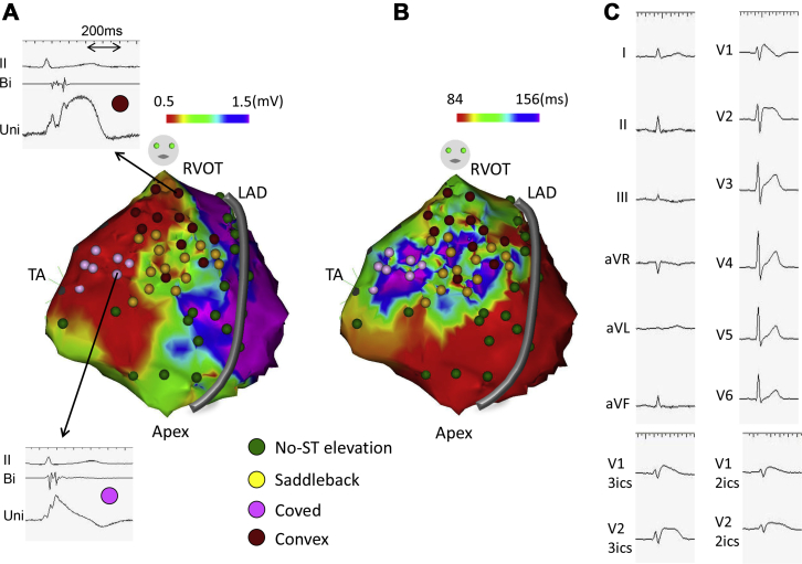 Figure 2